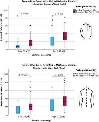 Changes in alpha, theta, and gamma oscillations in distinct cortical areas are associated with altered acute pain responses in chronic low back pain patients